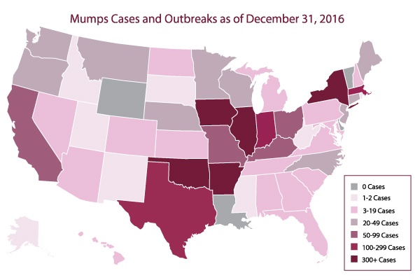 mumps-outbreak-map.jpg